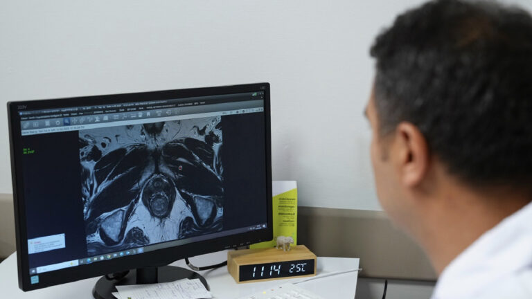 uzmanindan-prostat-kanserinde-dogru-tani-uyarisi-fuzyon-biyopsi-ile-tumor-odaklari-hedefe-yonelik-sekilde-tespit-edilebiliyor-MOf5SE33.jpg